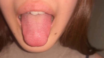 街角口内07