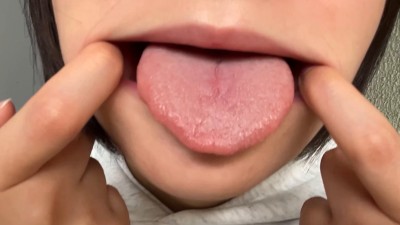 街角口内 01
