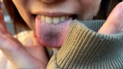 街角で声をかけて口内観察させてもらう オーガニックスーパー勤務 はつみちゃん