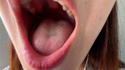 街角で声をかけて口内観察させてもらう ドラッグストア店員 あいるちゃん