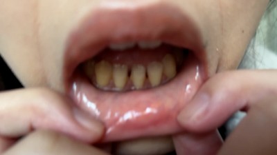 街角で声をかけて口内観察させてもらう コールセンターアルバイト あむちゃん