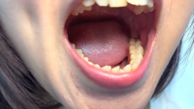 街角で声をかけて口内観察させてもらう テレビ局AD みゆりちゃん