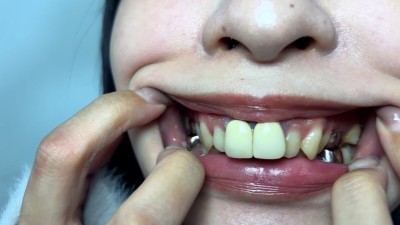 喉ちんこが可愛いゆのちゃんの口内観察